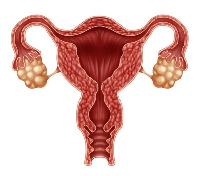 Vaginal Hysterectomy by OrangeCountySurgeons